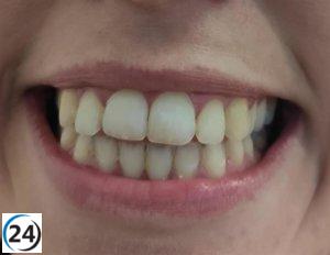 Recomendación del Codes: llevar a los niños al dentista temprano para prevenir patologías.